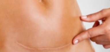 Dermopigmentation correctrice et réparatrice à Ensuès-la-Redonne