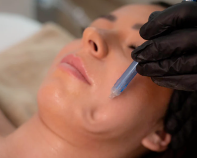 Jet Peel Ensuès-la-Redonne